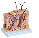 Skin Block Model