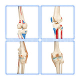Life Size Skeleton With Painted Muscles And Ligaments-180cm On Roller Stand