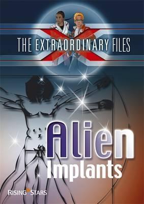 The Extraordinary Files: Alien Implants