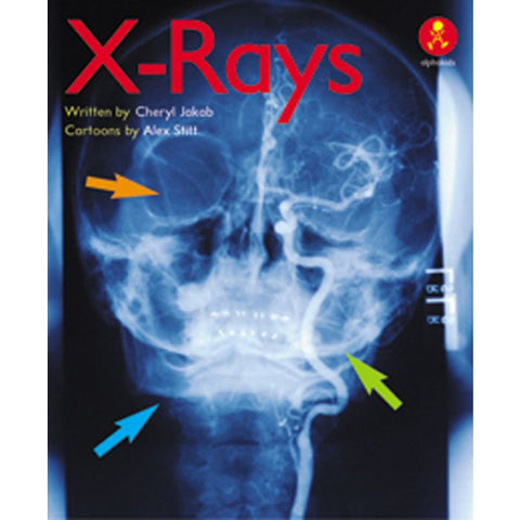 X-Rays